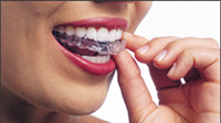 Invisalign